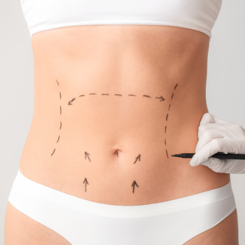 Bariatric Surgery — Gastric Sleeve & Bypass